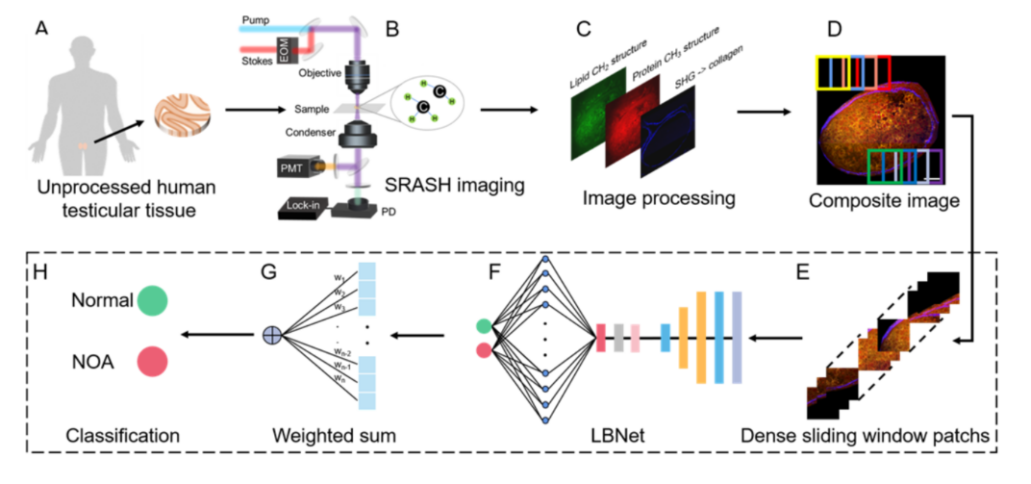 相干拉曼不用染色也能“看透”组织 (3).png