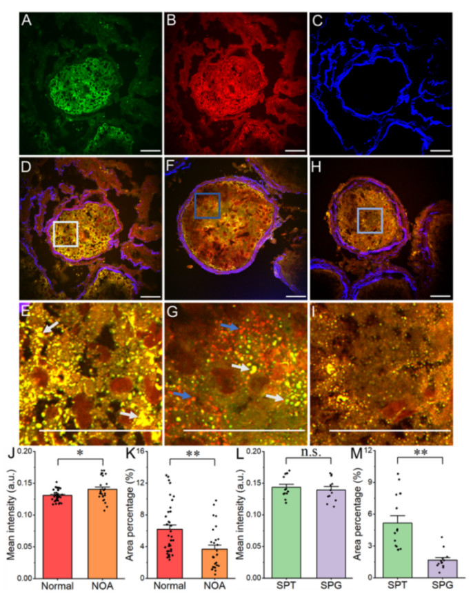 相干拉曼不用染色也能“看透”组织 (2).png