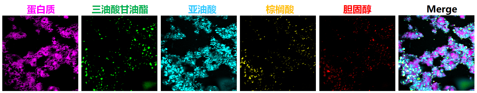 心脏类器官物质拆分